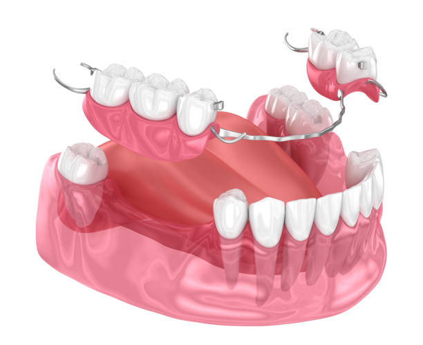 Prosthodontics